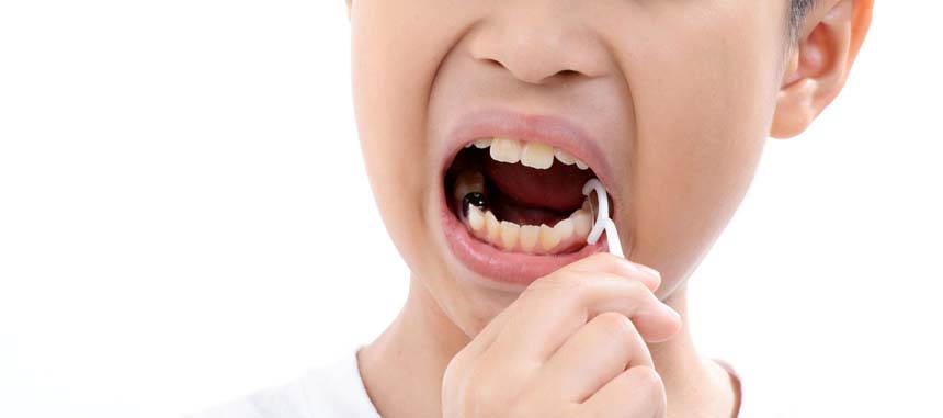 Do Kids Really Need to Floss Properly?