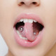 Oral Piercing: 6 Ways to Dental Damage